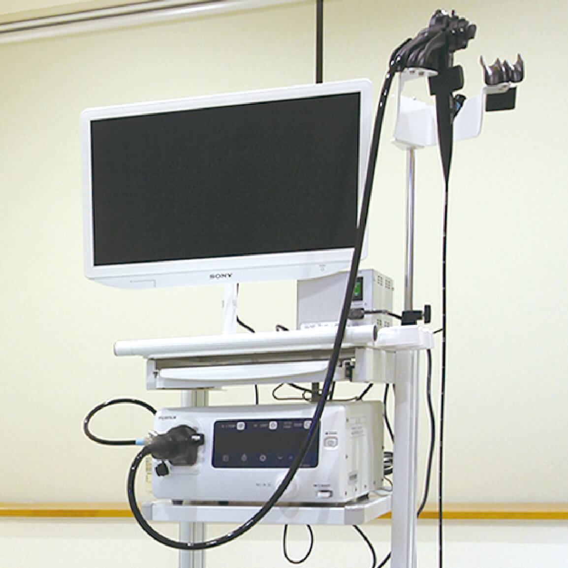 上部消化管内視鏡検査（胃カメラ）